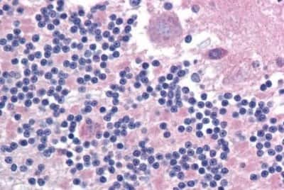 Immunohistochemistry-Paraffin: IGSF4D/SynCAM2/CADM2 Antibody [NBP3-14375]